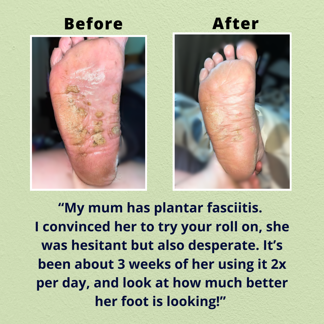 Intensive Foot Repair Roll-On